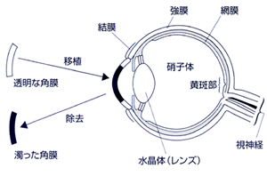 イラスト：眼球断面図